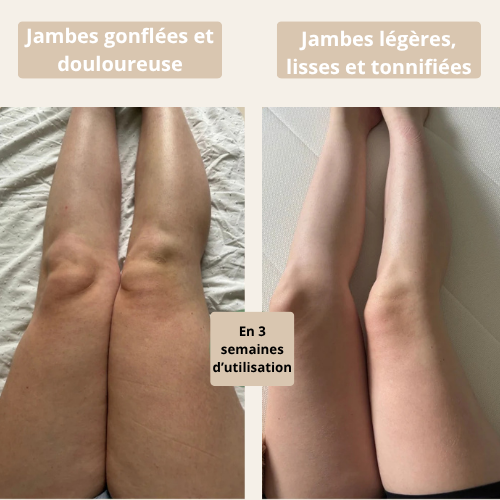 Brosse à Sec Anti-Lourdeurs – Jambes Légères & Tonifiées